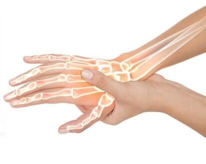 Hondrox se aplică pe zona afectată