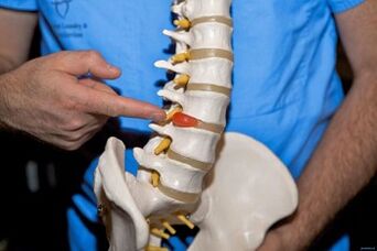 De ce durează spatele în partea inferioară a spatelui și ce să facă