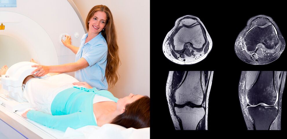 diagnosticul articulației genunchiului