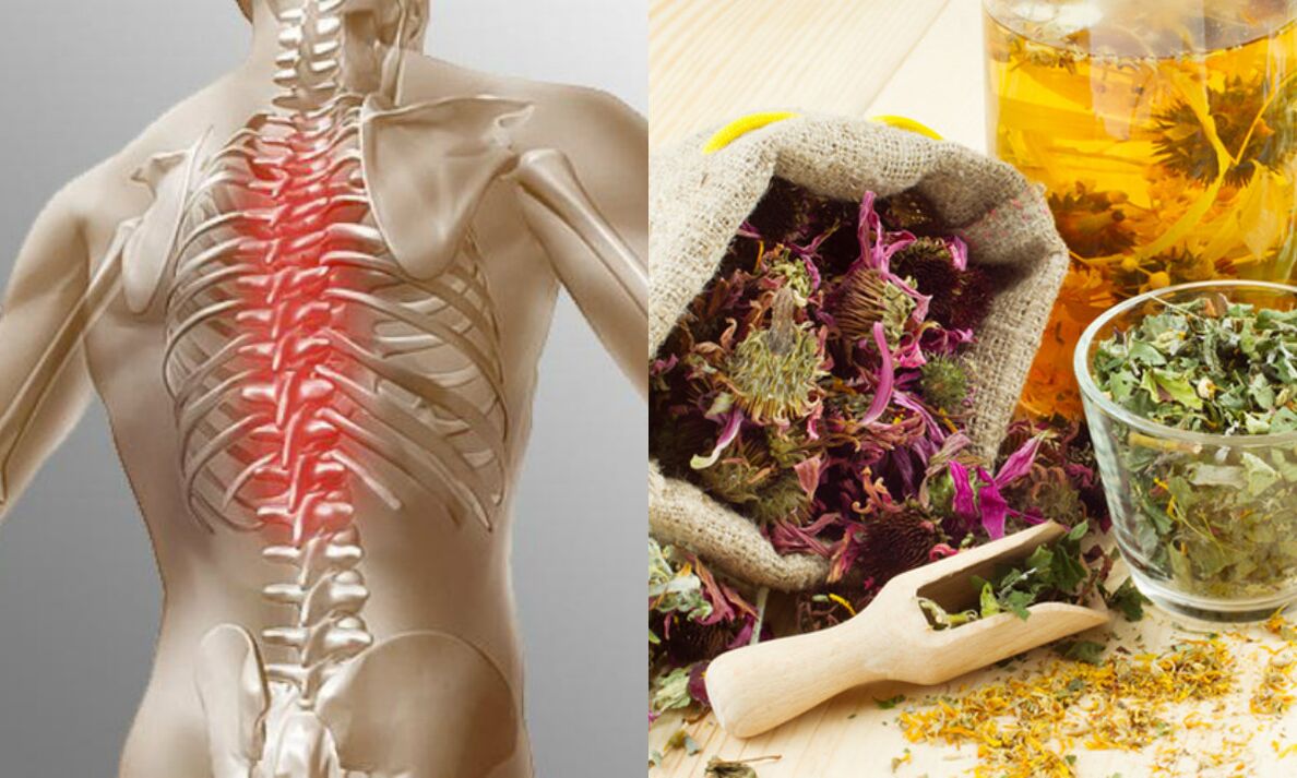 Metode populare de osteocondroza gâtului